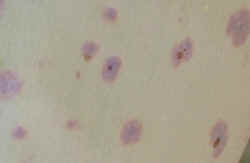 insekbyte_small.jpg (2572 bytes)